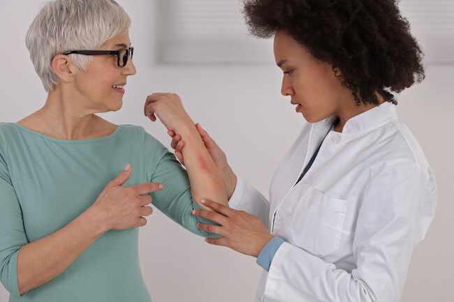 Apotheco Actinic Keratosis - Doctor examining patient's arm