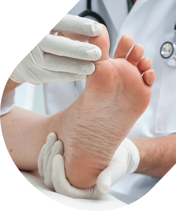 Apotheco Fungal Infections - Doctor dermatologist examines the foot