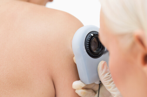 bare shoulder examined under a digital magnifier in a skin care pharmacy