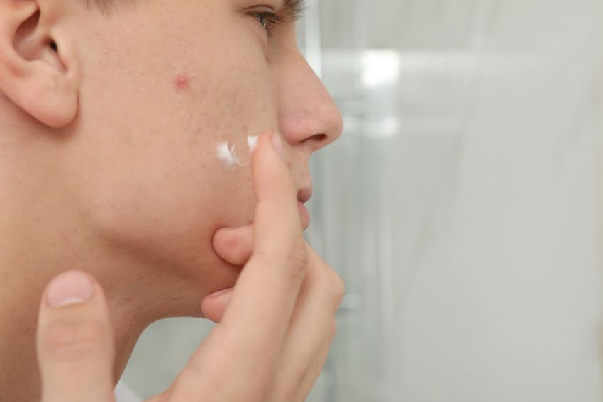 Prescription Adult Acne Treatments